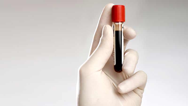 A blood test for glycated hemoglobin